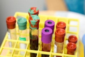 nutritionist blood tests for health